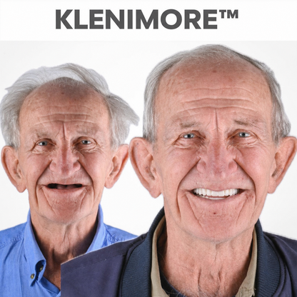⏰ Custom-Fit Dentures  ENDS TODAY   70% OFF | Smile with Confidence|Buy 2, Get 1 Free