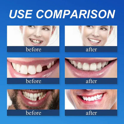 ⏰Ends Today: 70% OFF! 🌎Custom-Fit  Dentures— Designed for Comfort and a Natural-Looking Smile