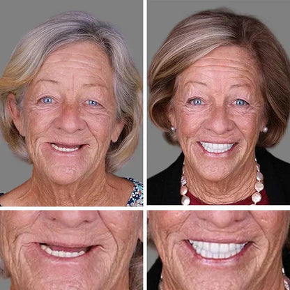 ⏰Ends Today: 70% OFF! 🌎Custom-Fit  Dentures— Designed for Comfort and a Natural-Looking Smile