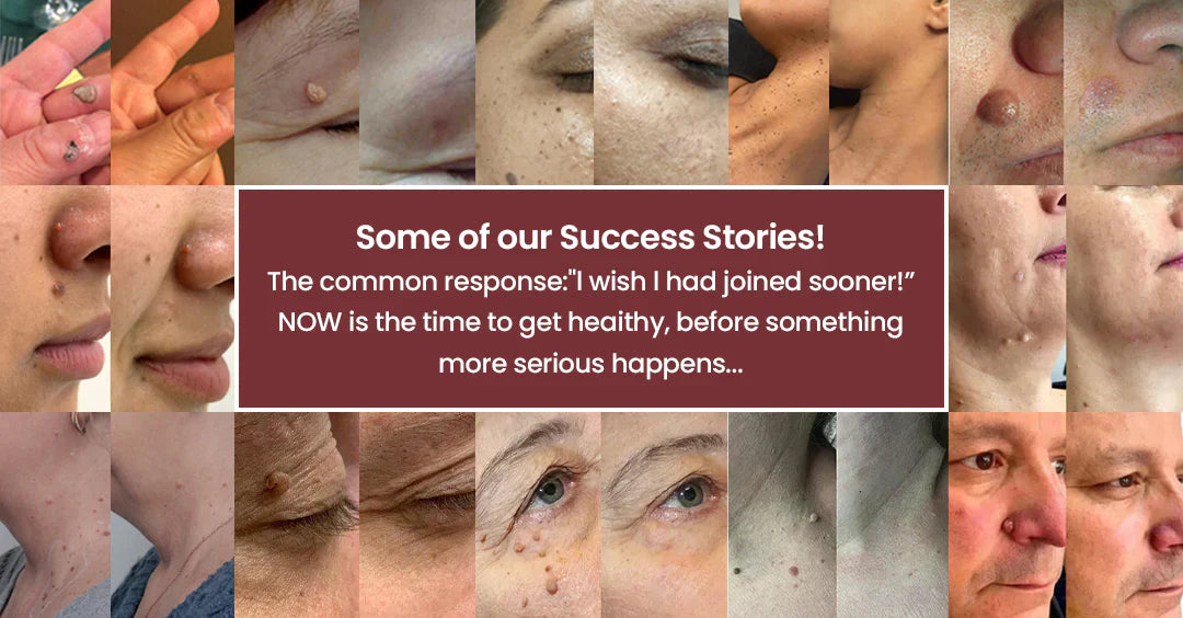 Skin concern examples